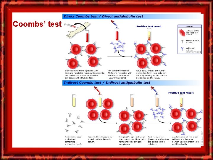 Coombs’ test 