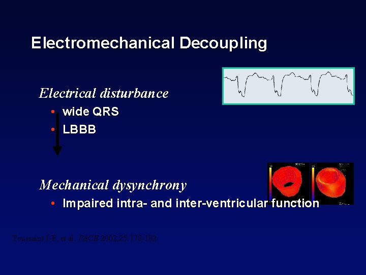 Electromechanical Decoupling Electrical disturbance • wide QRS • LBBB Mechanical dysynchrony • Impaired intra-