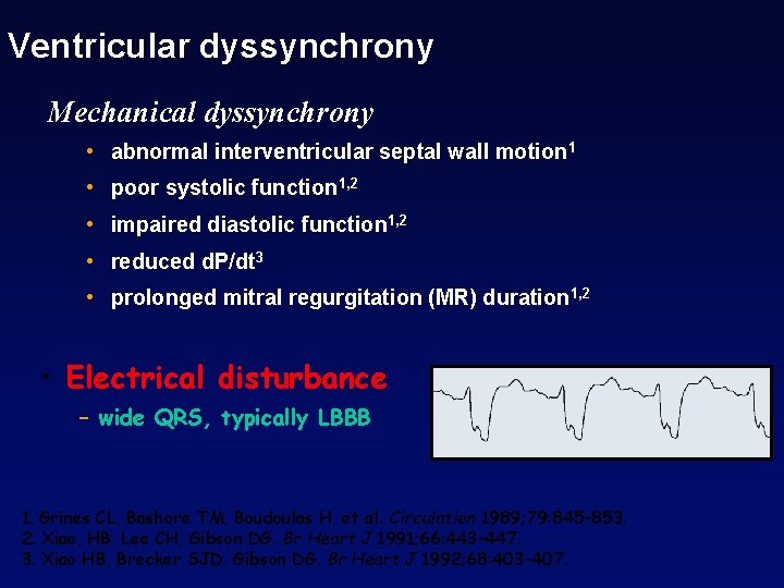 Ventricular dyssynchrony Mechanical dyssynchrony • abnormal interventricular septal wall motion 1 • poor systolic