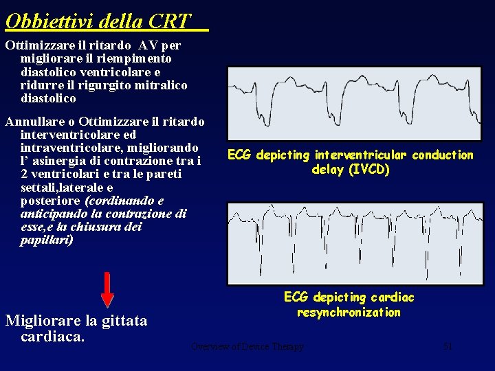 Obbiettivi della CRT Ottimizzare il ritardo AV per migliorare il riempimento diastolico ventricolare e