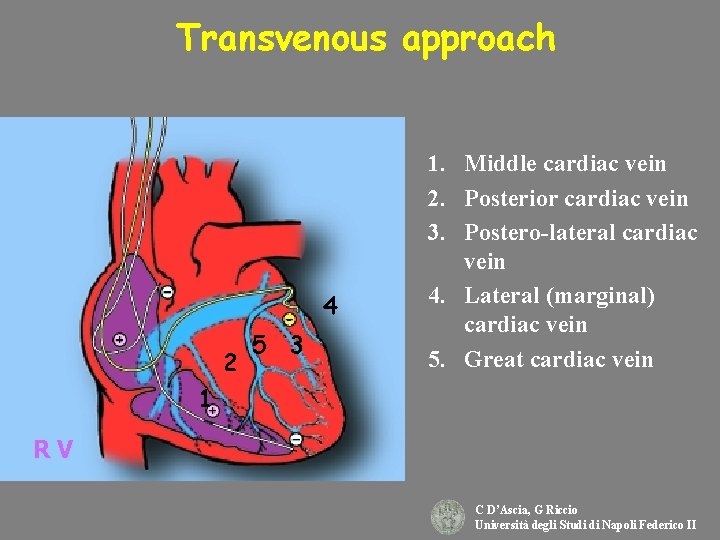 Transvenous approach 4 2 5 3 1. Middle cardiac vein 2. Posterior cardiac vein