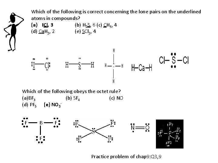 Which of the following is correct concerning the lone pairs on the underlined atoms