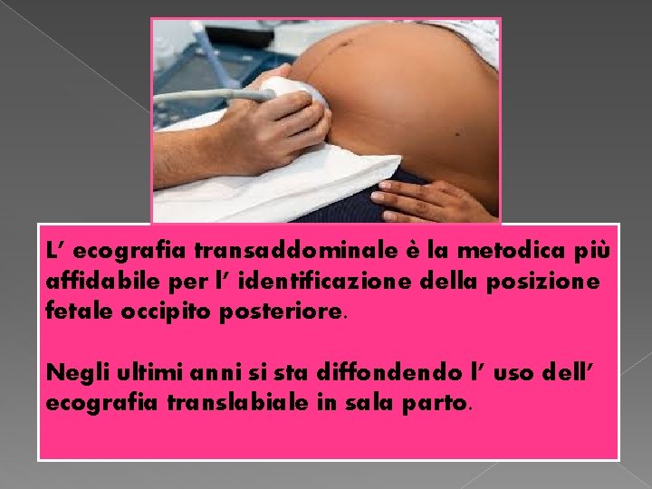L’ ecografia transaddominale è la metodica più affidabile per l’ identificazione della posizione fetale L’ ecografia transaddominale è la metodica più affidabile per l’ identificazione della posizione fetale