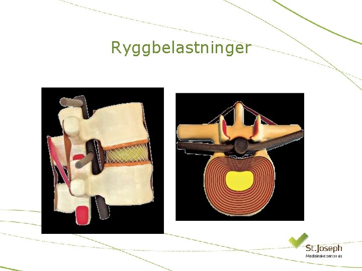 Ryggbelastninger 