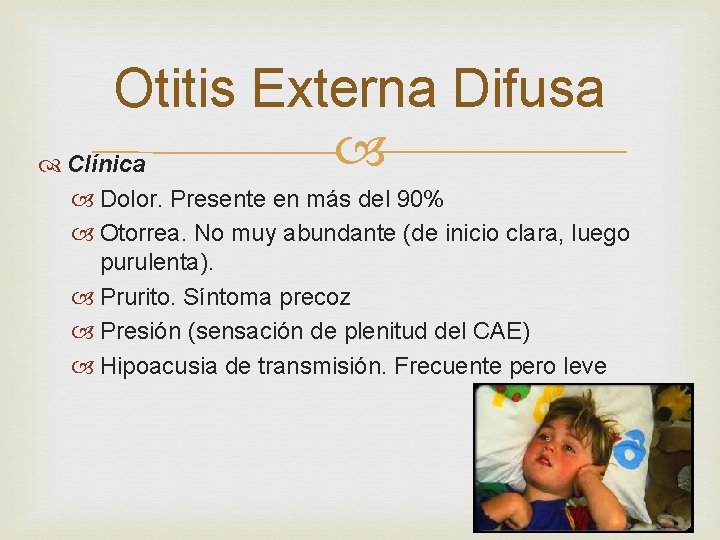 Otitis Externa Difusa Clínica Dolor. Presente en más del 90% Otorrea. No muy abundante