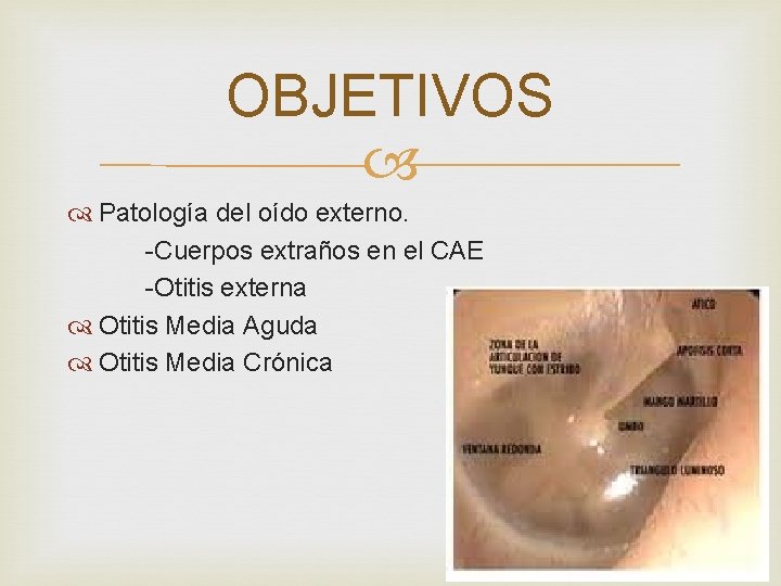 OBJETIVOS Patología del oído externo. -Cuerpos extraños en el CAE -Otitis externa Otitis Media