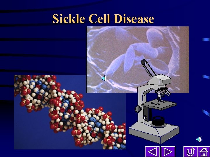 Sickle Cell Disease 