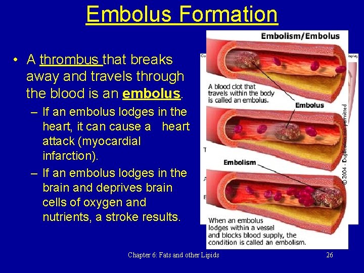 Embolus Formation • A thrombus that breaks away and travels through the blood is