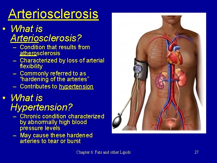 Arteriosclerosis • What is Arteriosclerosis? – Condition that results from atherosclerosis – Characterized by