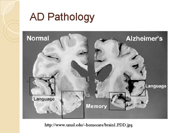 AD Pathology http: //www. umsl. edu/~homecare/brain 1. PDD. jpg AD Pathology http: //www. umsl. edu/~homecare/brain 1. PDD. jpg