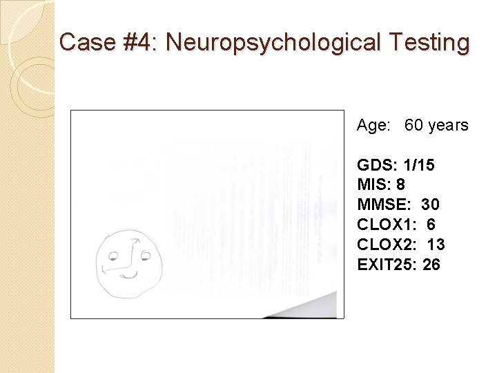 Case #4: Neuropsychological Testing Age: 60 years GDS: 1/15 MIS: 8 MMSE: 30 CLOX Case #4: Neuropsychological Testing Age: 60 years GDS: 1/15 MIS: 8 MMSE: 30 CLOX
