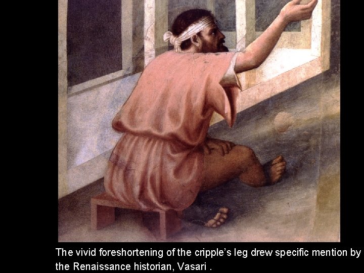 The vivid foreshortening of the cripple’s leg drew specific mention by the Renaissance historian, The vivid foreshortening of the cripple’s leg drew specific mention by the Renaissance historian,