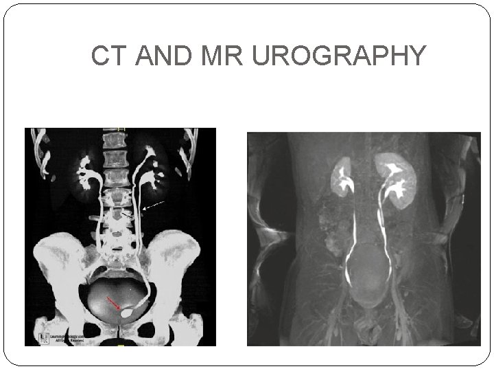 CT AND MR UROGRAPHY 