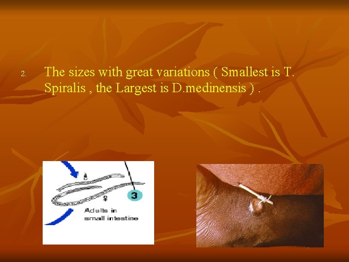 2. The sizes with great variations ( Smallest is T. Spiralis , the Largest 2. The sizes with great variations ( Smallest is T. Spiralis , the Largest