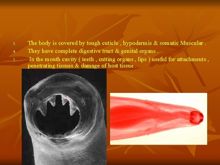 3. 4. 5. The body is covered by tough cuticle , hypodermis & somatic 3. 4. 5. The body is covered by tough cuticle , hypodermis & somatic