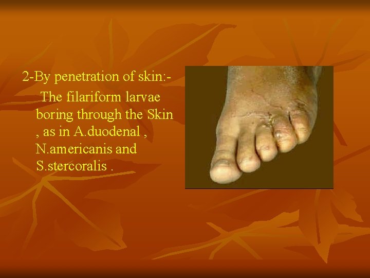 2 -By penetration of skin: The filariform larvae boring through the Skin , as 2 -By penetration of skin: The filariform larvae boring through the Skin , as