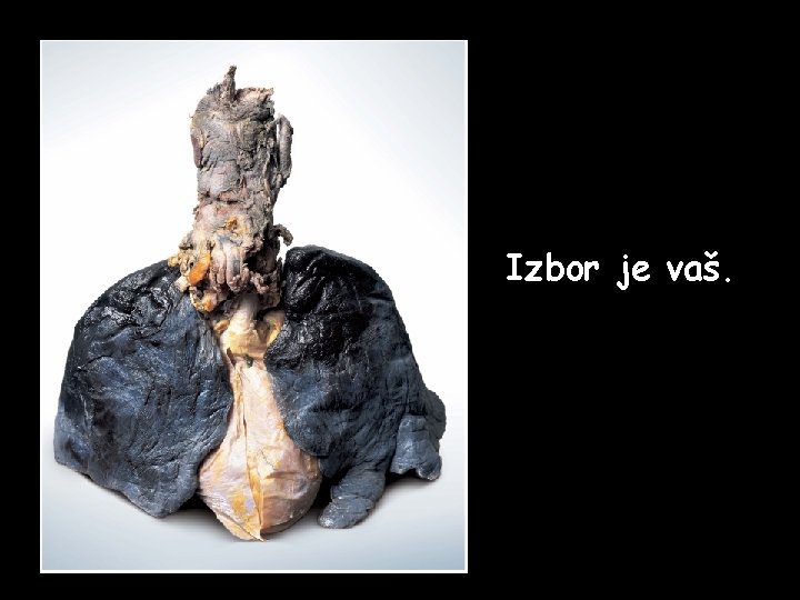 Izbor je vaš. Izbor je vaš.
