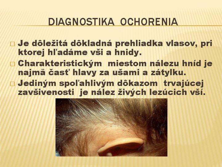 DIAGNOSTIKA OCHORENIA Je dôležitá dôkladná prehliadka vlasov, pri ktorej hľadáme vši a hnidy. �