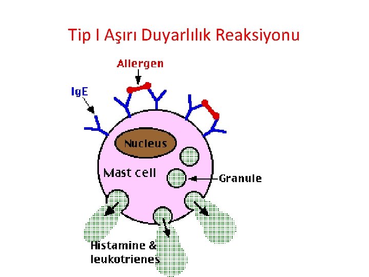 Tip I Aşırı Duyarlılık Reaksiyonu 