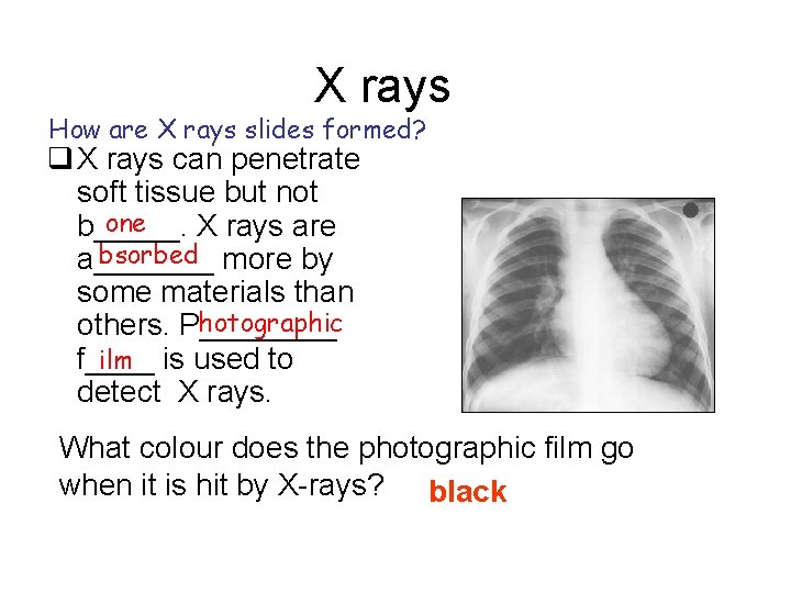 X rays How are X rays slides formed? q X rays can penetrate soft