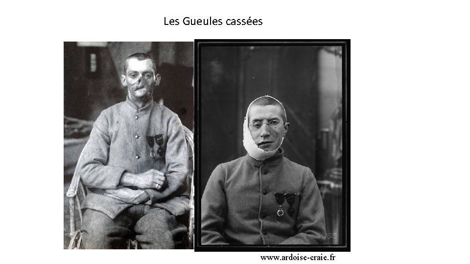 Les Gueules cassées www. ardoise-craie. fr 