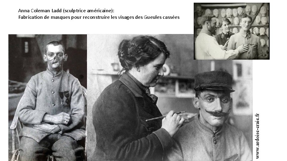 www. ardoise-craie. fr Anna Coleman Ladd (sculptrice américaine): Fabrication de masques pour reconstruire les