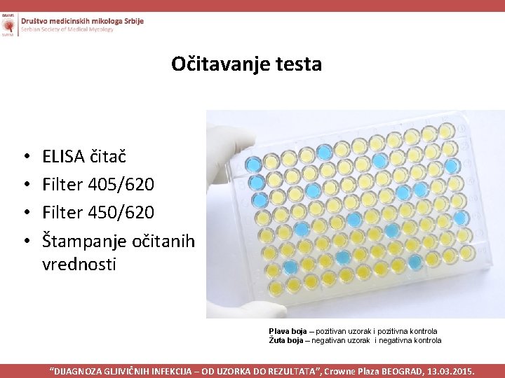 Očitavanje testa • • ELISA čitač Filter 405/620 Filter 450/620 Štampanje očitanih vrednosti Plava