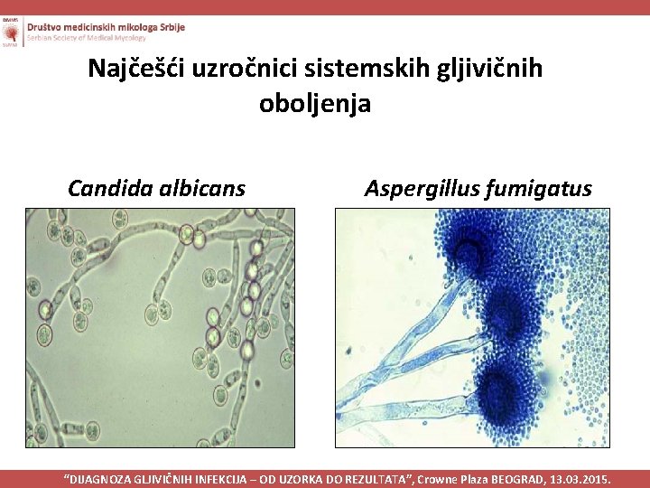 Najčešći uzročnici sistemskih gljivičnih oboljenja Candida albicans Aspergillus fumigatus “DIJAGNOZA GLJIVIČNIH INFEKCIJA – OD