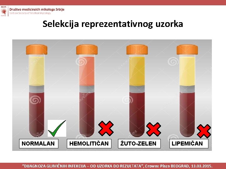 Selekcija reprezentativnog uzorka NORMALAN HEMOLITIČAN ŽUTO-ZELEN LIPEMIČAN “DIJAGNOZA GLJIVIČNIH INFEKCIJA – OD UZORKA DO