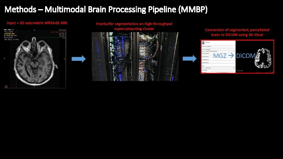 Methods – Multimodal Brain Processing Pipeline (MMBP) 
