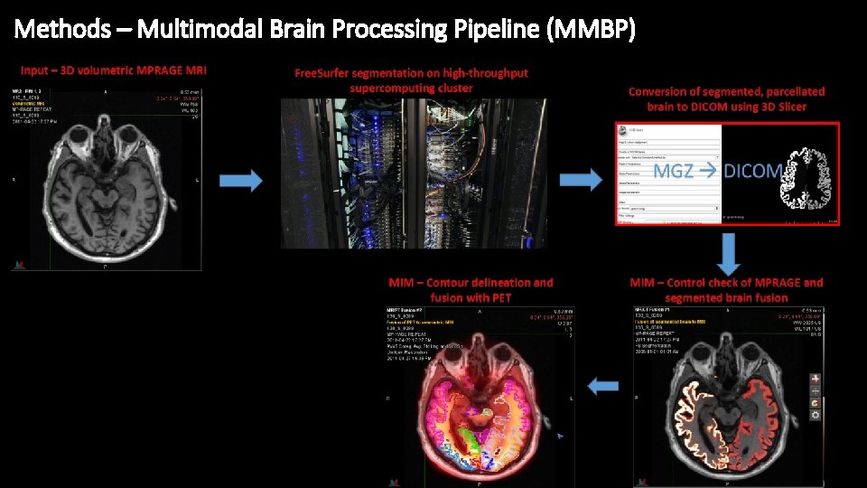 Methods – Multimodal Brain Processing Pipeline (MMBP) 