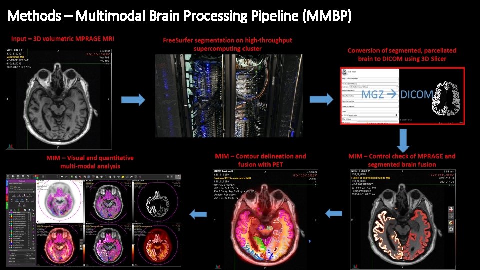 Methods – Multimodal Brain Processing Pipeline (MMBP) 