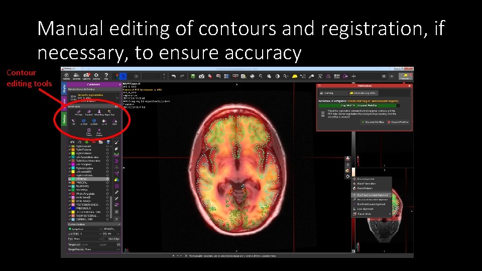 Manual editing of contours and registration, if necessary, to ensure accuracy Contour editing tools