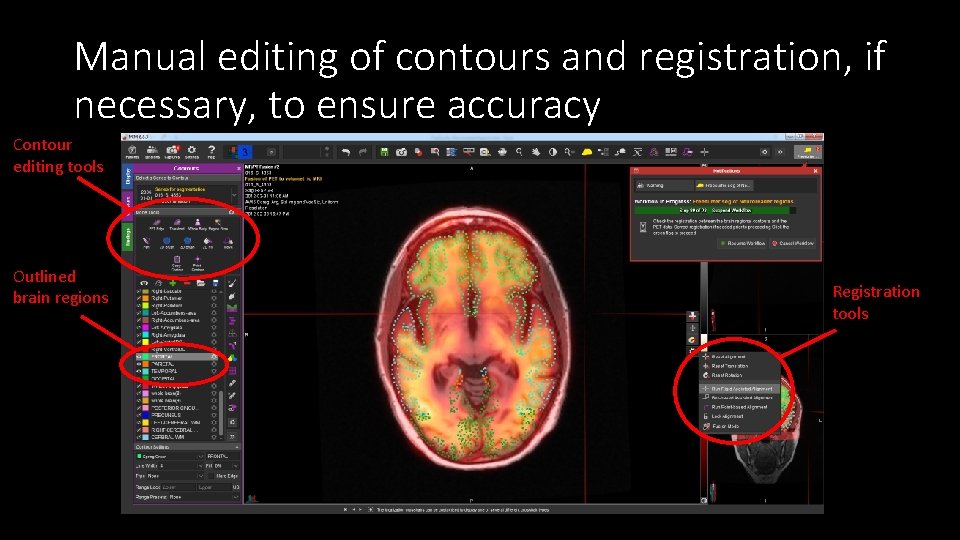 Manual editing of contours and registration, if necessary, to ensure accuracy Contour editing tools