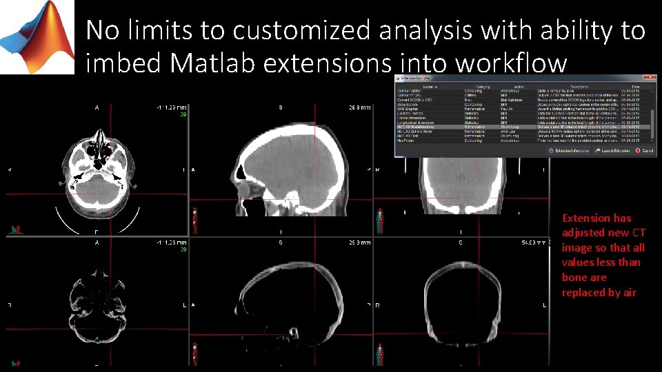 No limits to customized analysis with ability to imbed Matlab extensions into workflow Extension
