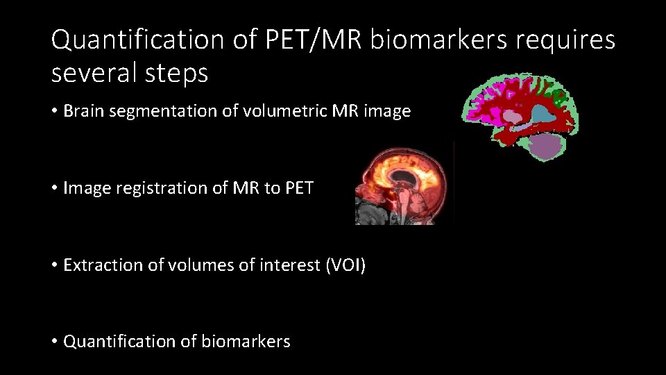 Quantification of PET/MR biomarkers requires several steps • Brain segmentation of volumetric MR image