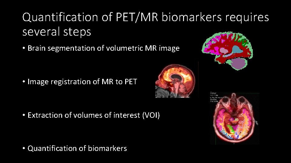 Quantification of PET/MR biomarkers requires several steps • Brain segmentation of volumetric MR image