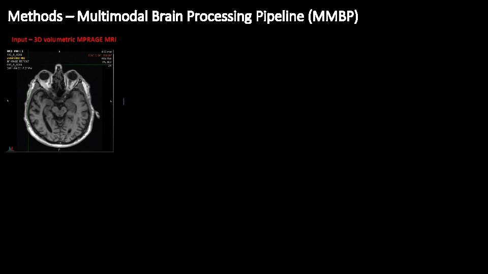 Methods – Multimodal Brain Processing Pipeline (MMBP) 