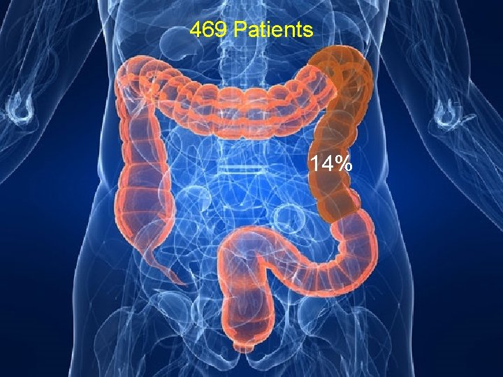 469 Patients 14% 
