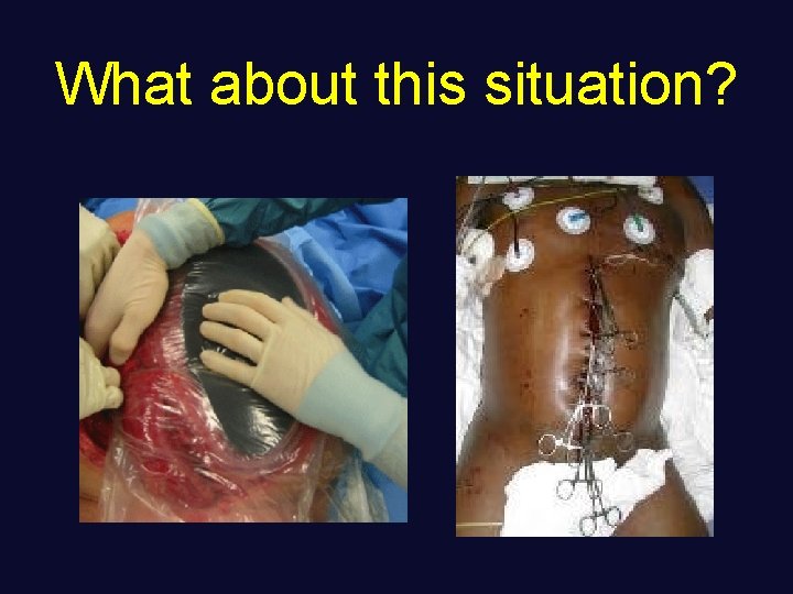 What about this situation? 