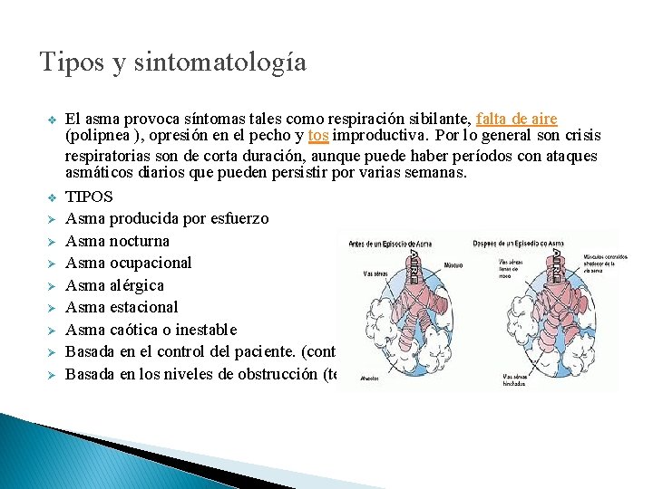 Tipos y sintomatología v v Ø Ø Ø Ø El asma provoca síntomas tales Tipos y sintomatología v v Ø Ø Ø Ø El asma provoca síntomas tales