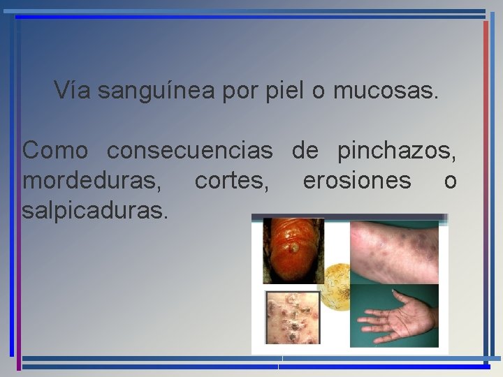 Vía sanguínea por piel o mucosas. Como consecuencias de pinchazos, mordeduras, cortes, erosiones o