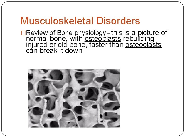 Musculoskeletal Disorders �Review of Bone physiology – this is a picture of normal bone,