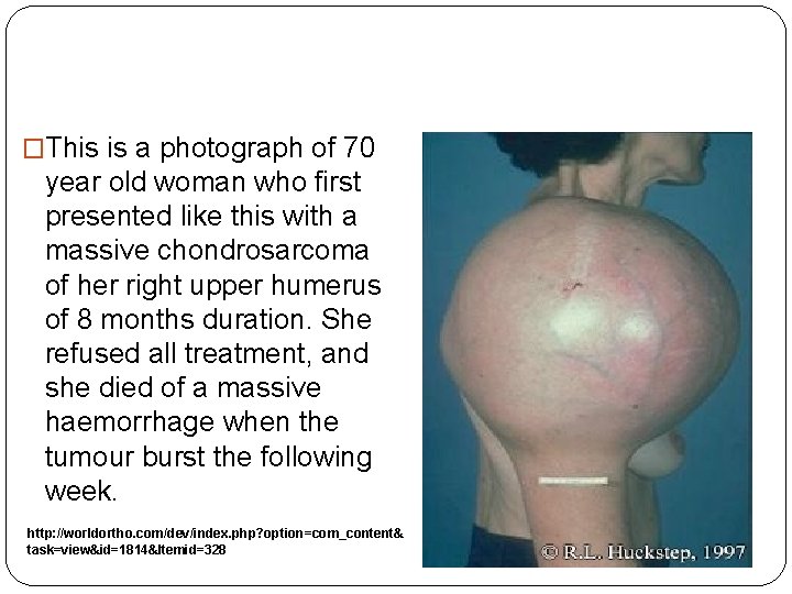 �This is a photograph of 70 year old woman who first presented like this