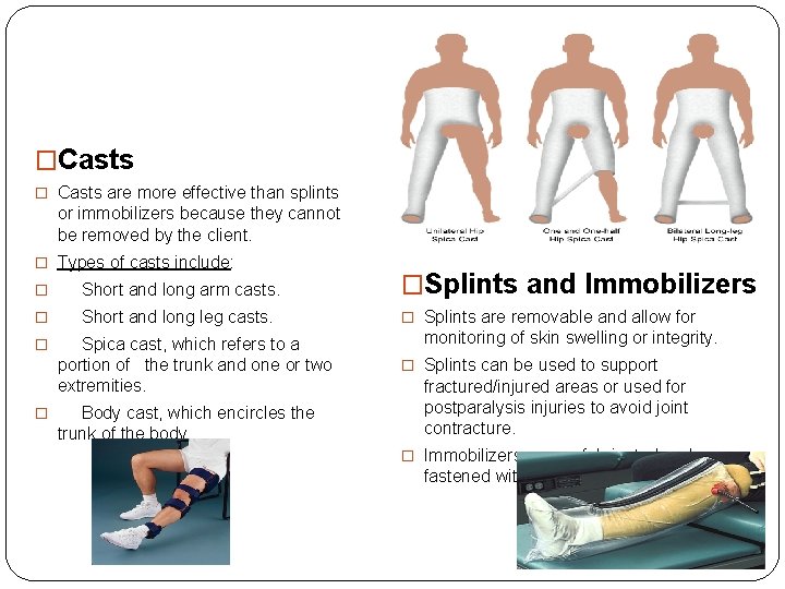 �Casts � Casts are more effective than splints or immobilizers because they cannot be