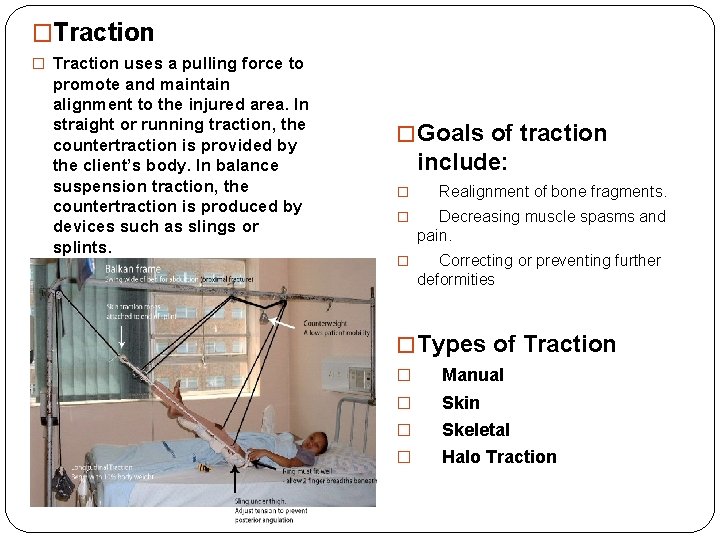 �Traction � Traction uses a pulling force to promote and maintain alignment to the