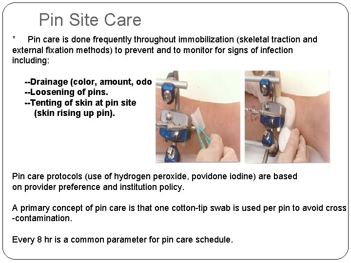 Pin Site Care * Pin care is done frequently throughout immobilization (skeletal traction and