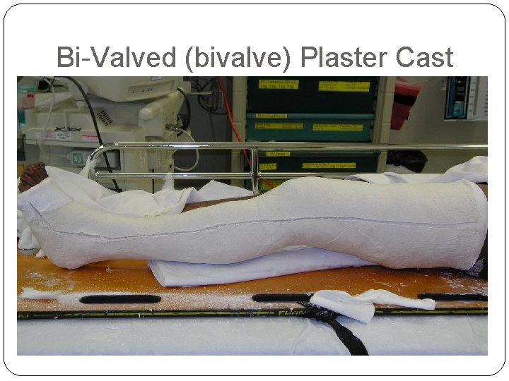 Bi-Valved (bivalve) Plaster Cast 