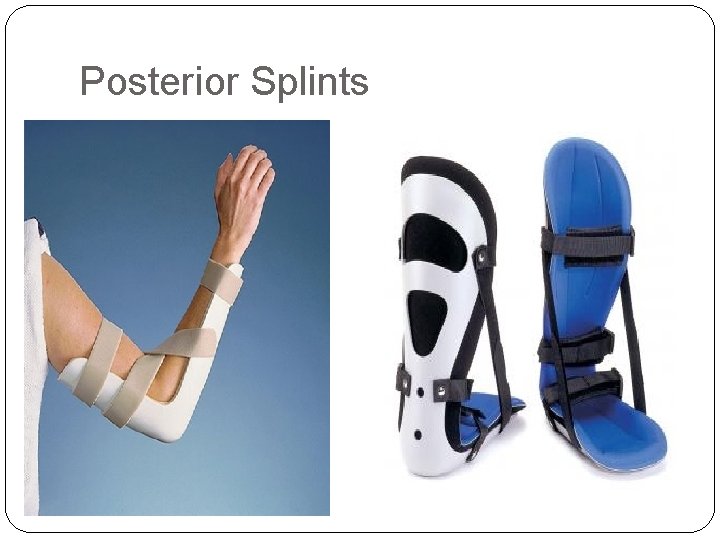 Posterior Splints 