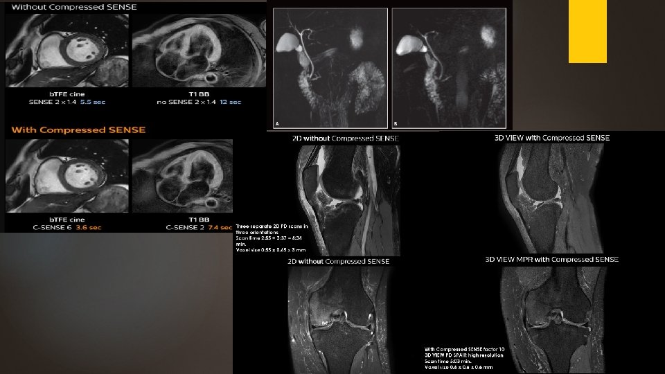 Compressed Sensing Multiband Mri A New Approach To